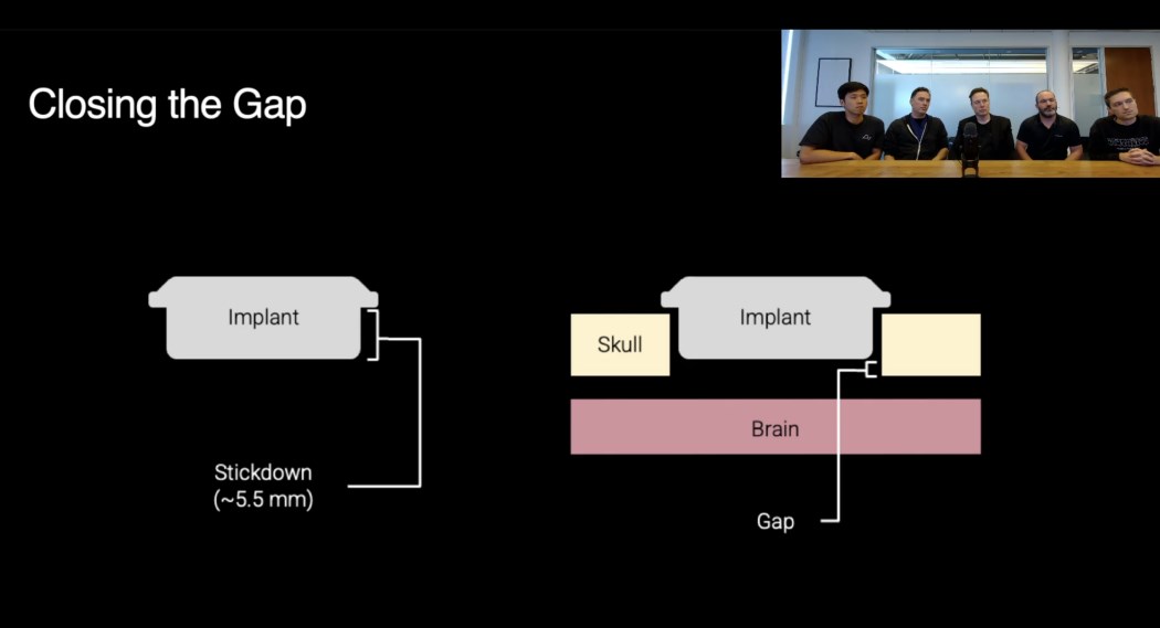 Musk'ın Neuralink beyin çipi ikinci deneme için hazır