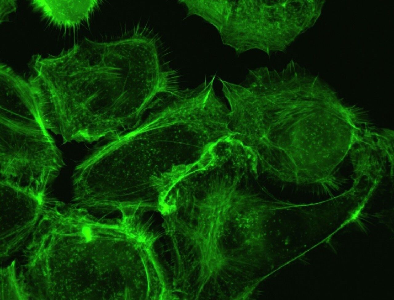 Yapay zeka aracı kanser hücrelerini nano ölçekte tespit edecek